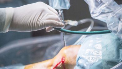 Sutura do menisco quando ela é indicada