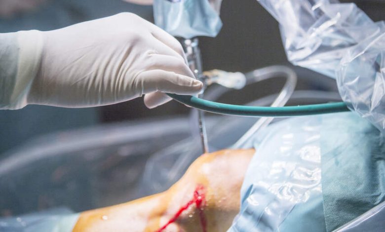 Sutura do menisco quando ela é indicada